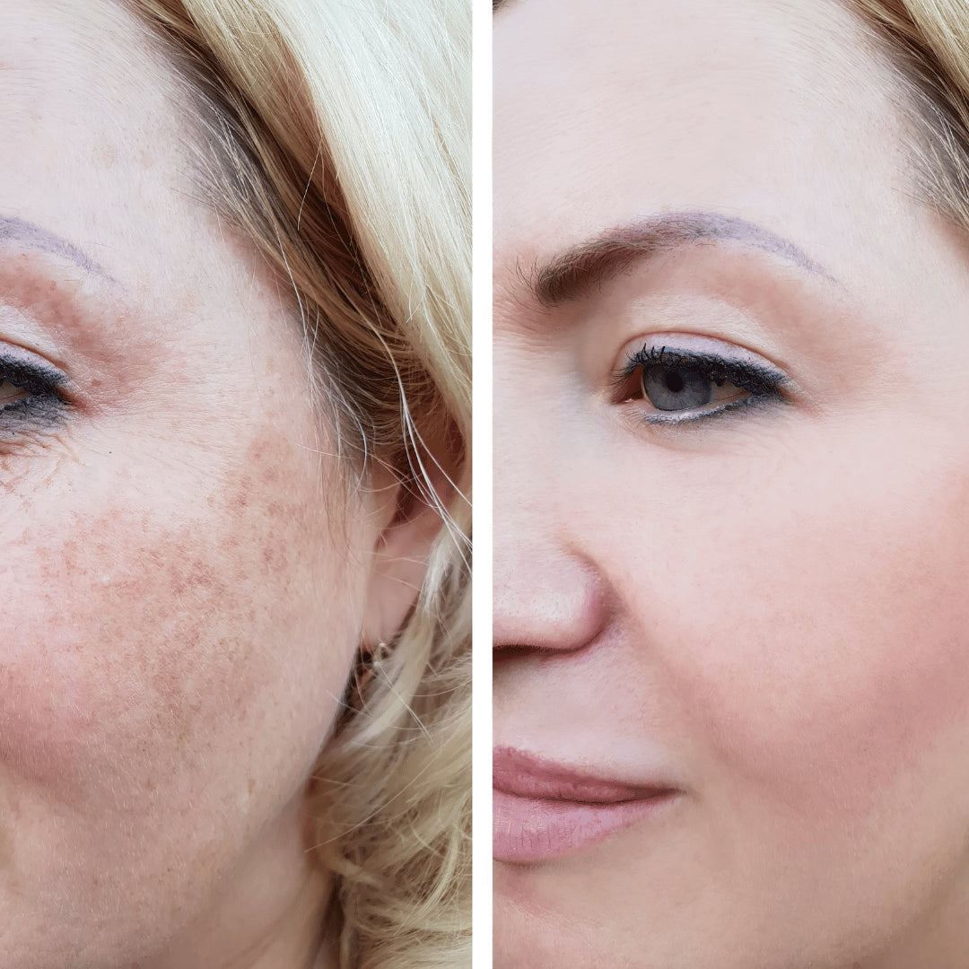 [Dr.Melaxin Official] Peel Shot Spray